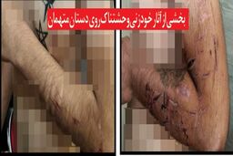 حمله خونین به مرد پاکبان برای دزدیدن موتور