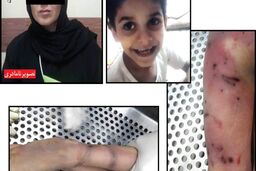 مرگ کودک 7 ساله زیر شکنجه های نامادری در مشهد