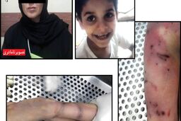 مرگ کودک 7 ساله زیر شکنجه های نامادری در مشهد