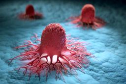 گسترش سرطان در زیر 50 ساله‌ها