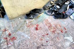 پسر کینه‌جو 9 نفر را در جنوب تهران آتش زد؛ برخی مصدومان بدحال هستند