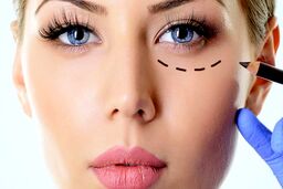 چند روش آسان و ارزان برای درمان گودی زیر چشم در خانه
