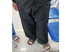 سارق پشیمان خودش را به آتش کشید