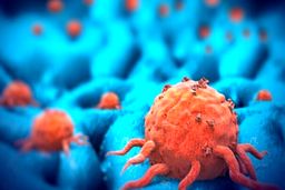 روند رو به افزایش سرطان‌ها در کشور