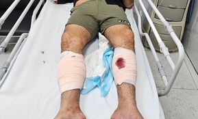 شرور سابقه‌دار عامل ضرب‌وشتم بانوان با شلیک پلیس تهران زمین‌گیر شد