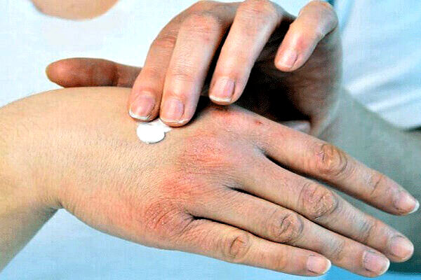 راهکارهای ساده برای جلوگیری از خشکی پوست در پاییز