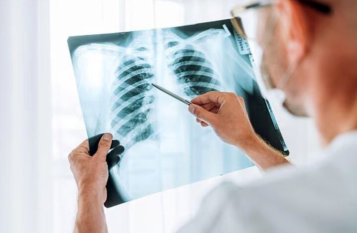 چرا آنفلوآنزا گاهی کشنده می‌شود؟